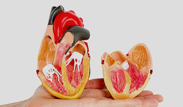 심장혈관·말초혈관 컴퓨터 단층촬영 이미지